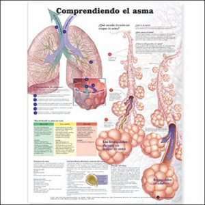  Understanding Asthma in Spanish Chart/Poster