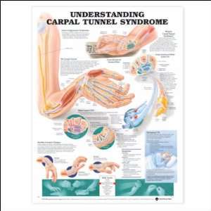  Understanding Carpal Tunnel Syndrome Anatomical Chart 20 