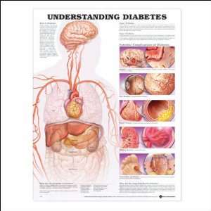  Understanding Diabetes Anatomical Chart 20 X 26 