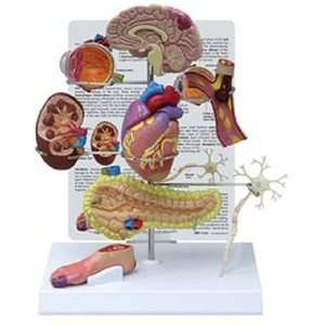   Diabetes Human Anatomy/Anatomical Model #4010 Industrial & Scientific